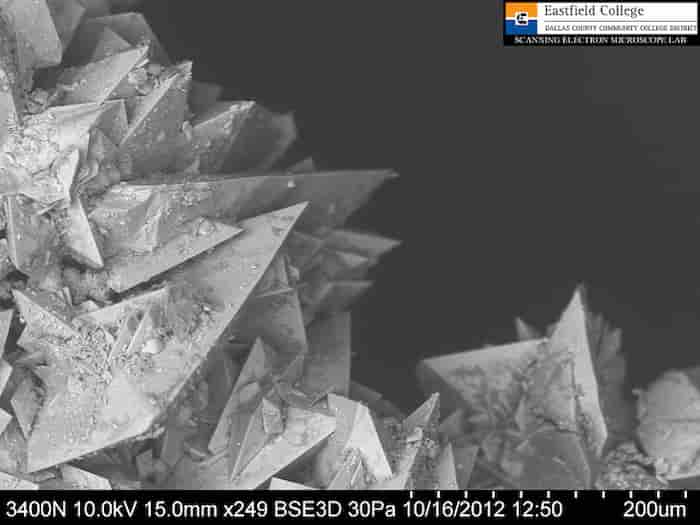 تصاویر سنگ کلیه زیر میکروسکوپ الکترونی