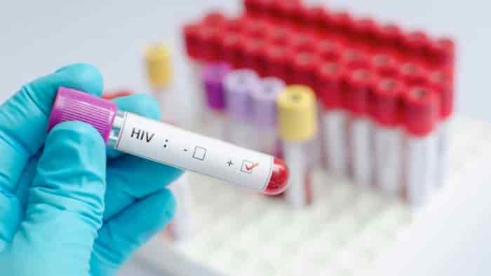 دانشمندان با CRISPR ویروس HIV را از سلول‌های آلوده حذف می‌کنند
